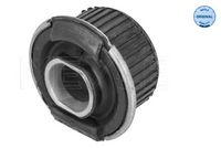 MEYLE 014 035 0091 - Suspensión, cuerpo del eje